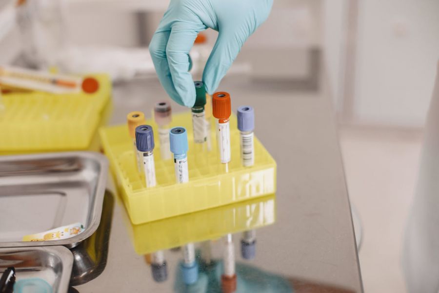 Teste alergologice pentru un diagnostic corect