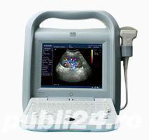 Ecograf doppler color