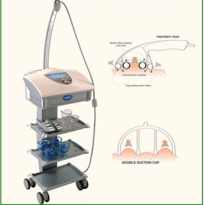 StarVac Sp 2  Pret Convenabil