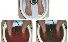 Detoxifiere ionica prin talpi Pitesti