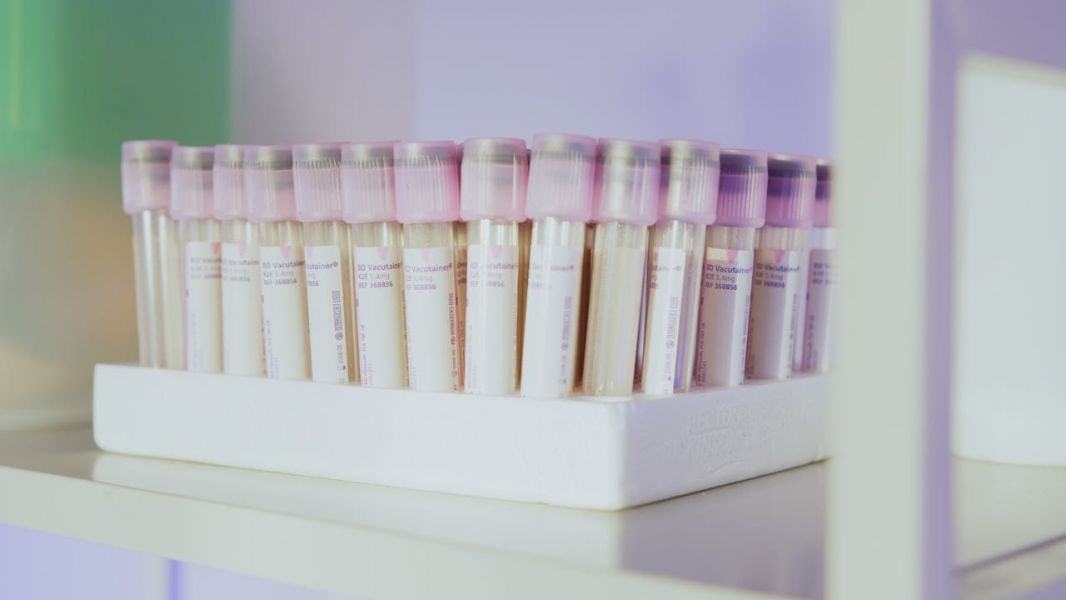 Teste hormonale in endocrinologie moderna