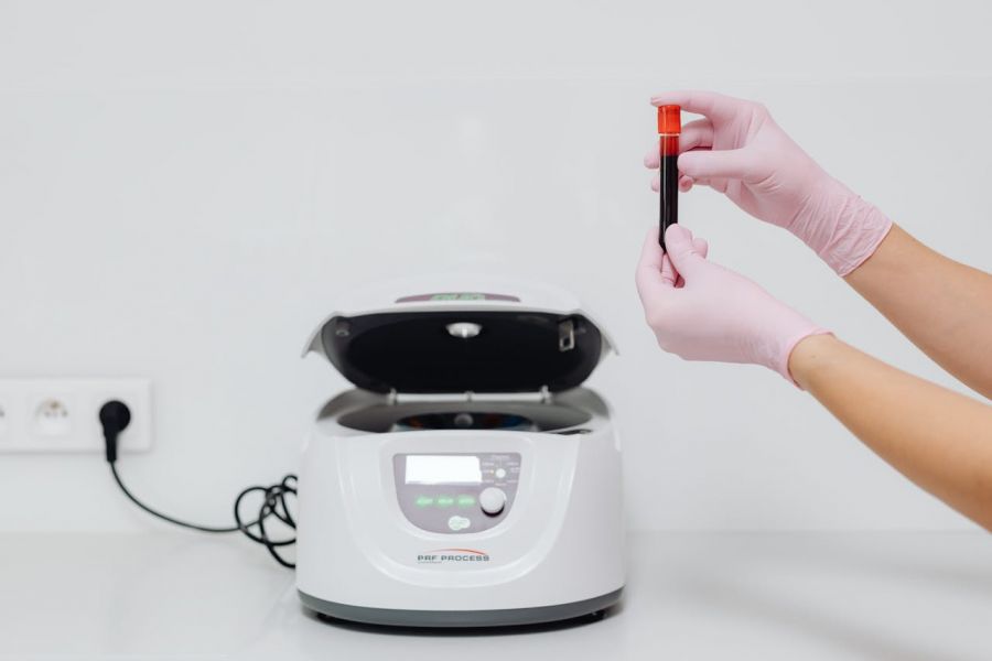 Test D-Dimeri pentru evaluarea coagularii sangelui